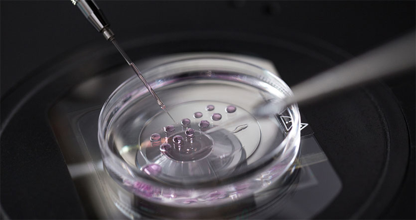 IVF-Behandlung