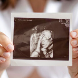 Tüp Bebek Tedavisinde Başarı