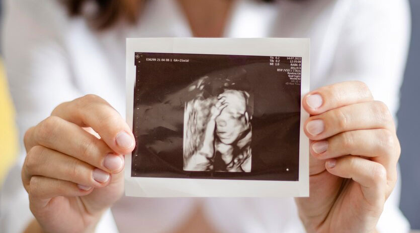 Tüp Bebek Tedavisinde Başarı