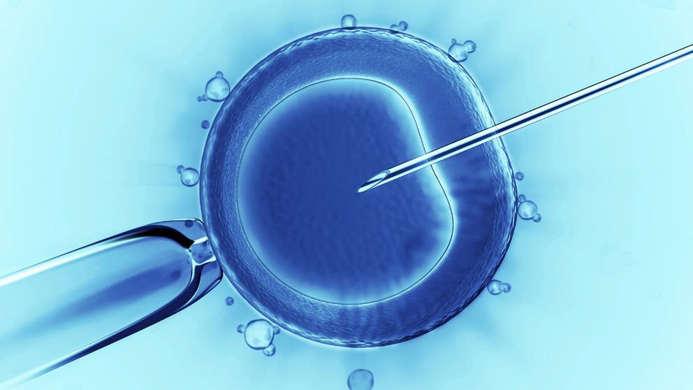 IVF Mikroinjektion
