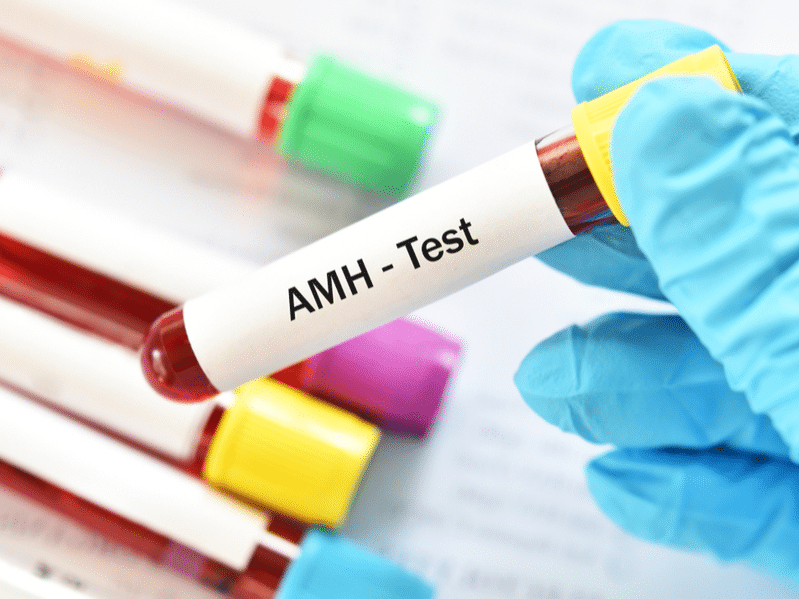 AMH-Test
