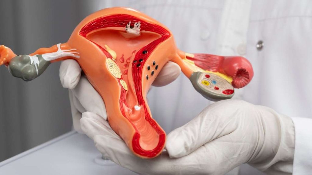 Gebärmutterschleimhaut