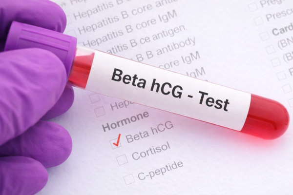 Wann wird Beta HCG gemessen