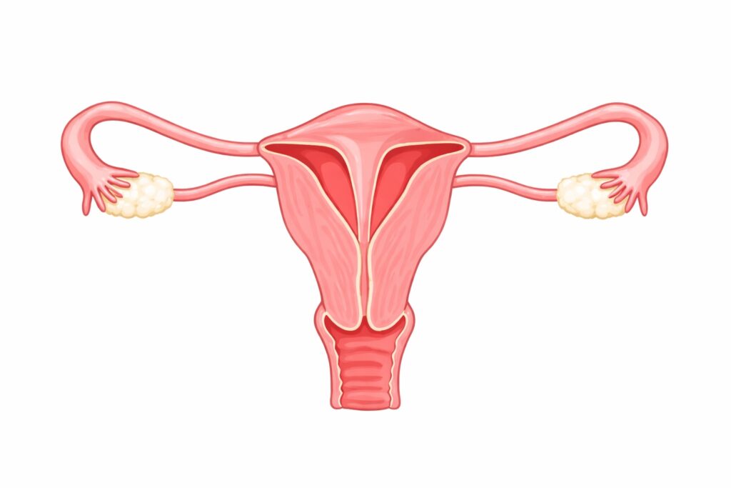 Intrauterine Verwachsungen