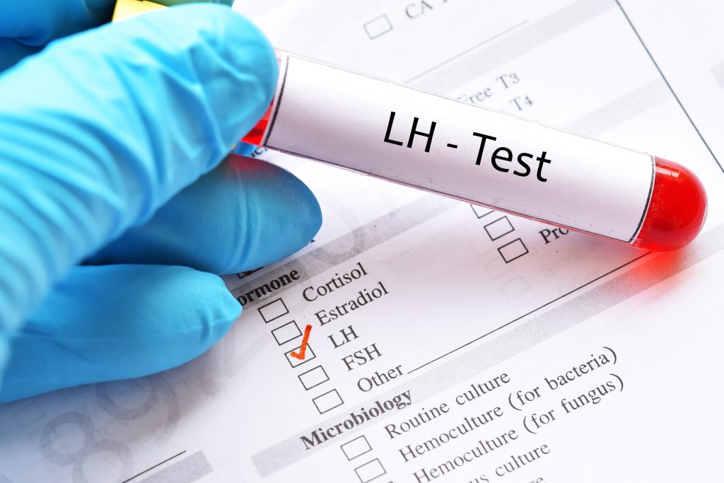 What is LH hormone and What should its levels be