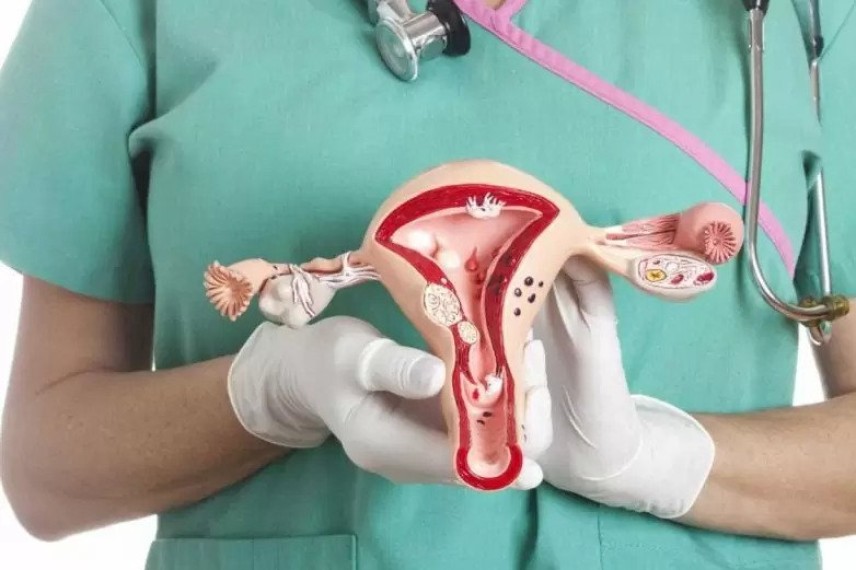 What Are They Myomas and How Are They Treated