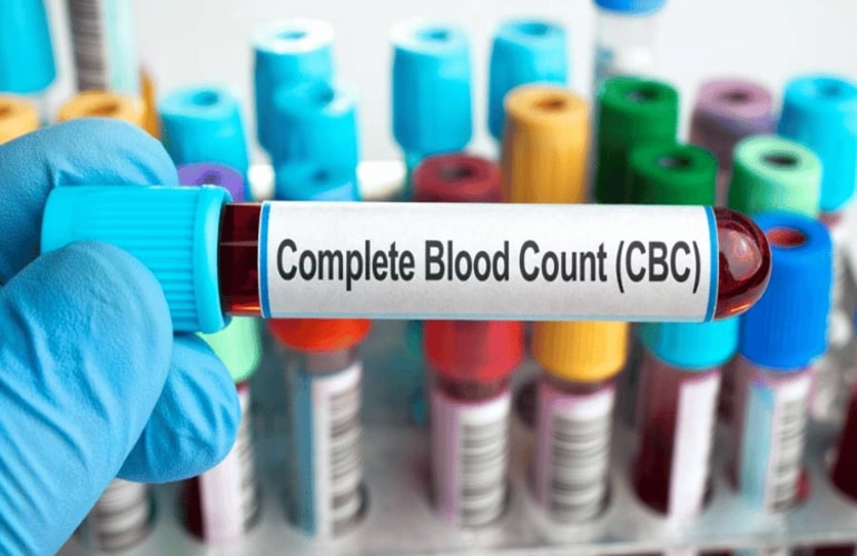 What is the Importance of CBC Test During Pregnancy