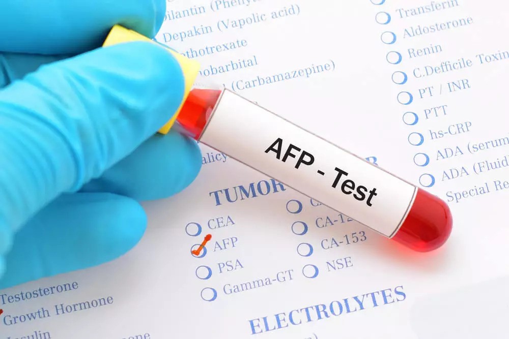 What is the Alpha Fetoprotein Test