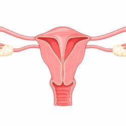 Intrauterine Adhesions