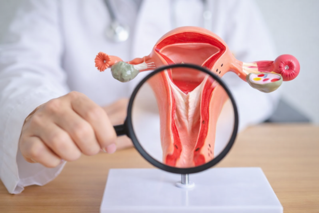 Treatment of Intrauterine Septum