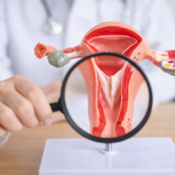 Treatment of Intrauterine Septum