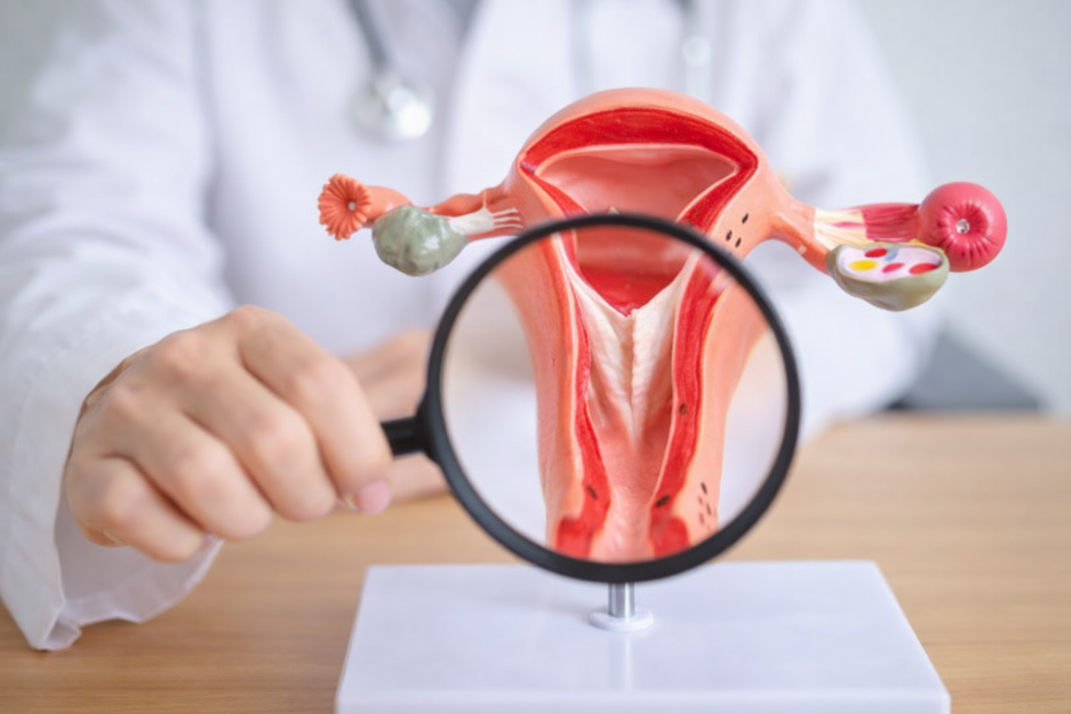 Treatment of Intrauterine Septum